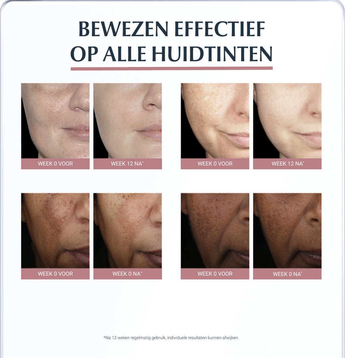 Eucerin Anti-pigment Serum duo - 30 ml